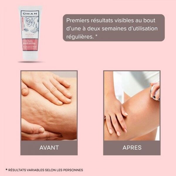 Crème anti-cellulite effet chaud Uman - 200 ml